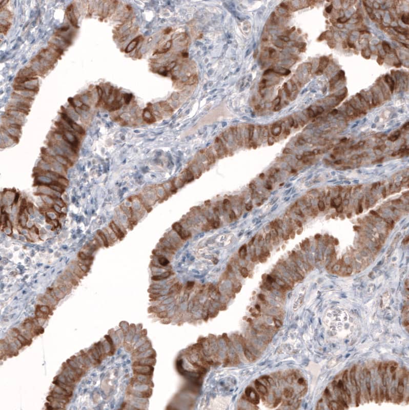 HMG-CoA Reductase/HMGCR Antibody (CL0260) Immunohistochemistry: HMG-CoA Reductase/HMGCR Antibody (CL0260) [NBP3-52096]