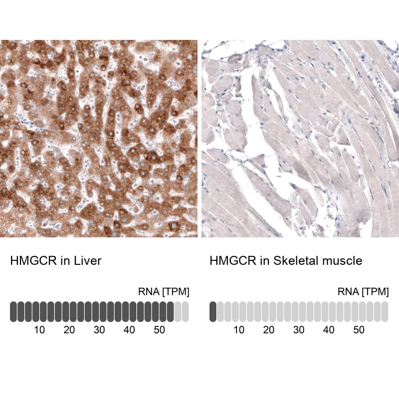 HMG-CoA Reductase/HMGCR Antibody (CL0260) Immunohistochemistry: HMG-CoA Reductase/HMGCR Antibody (CL0260) [NBP3-52096]