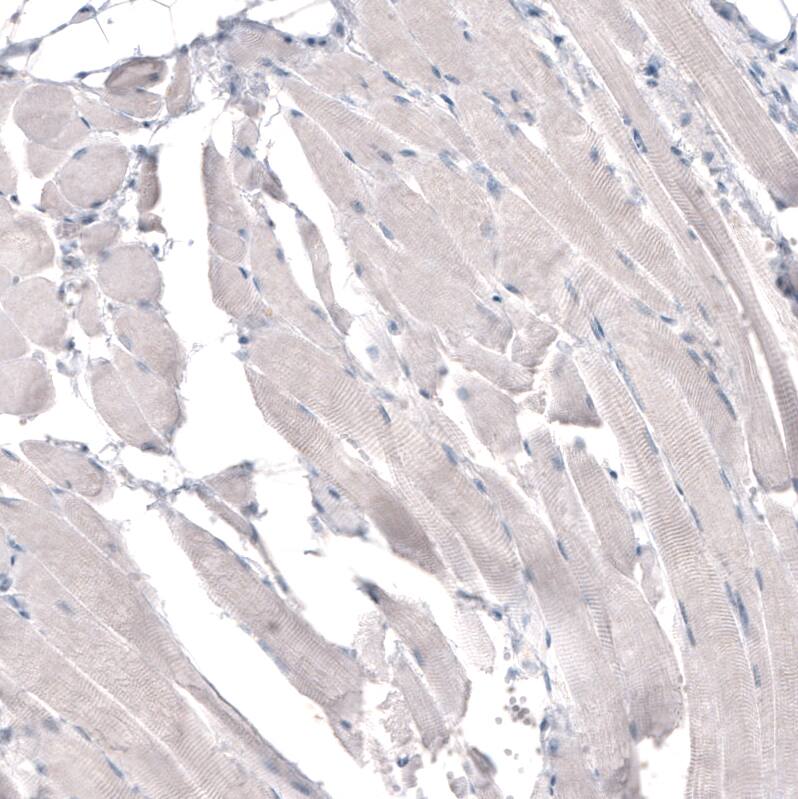 HMG-CoA Reductase/HMGCR Antibody (CL0260) Immunohistochemistry: HMG-CoA Reductase/HMGCR Antibody (CL0260) [NBP3-52096]