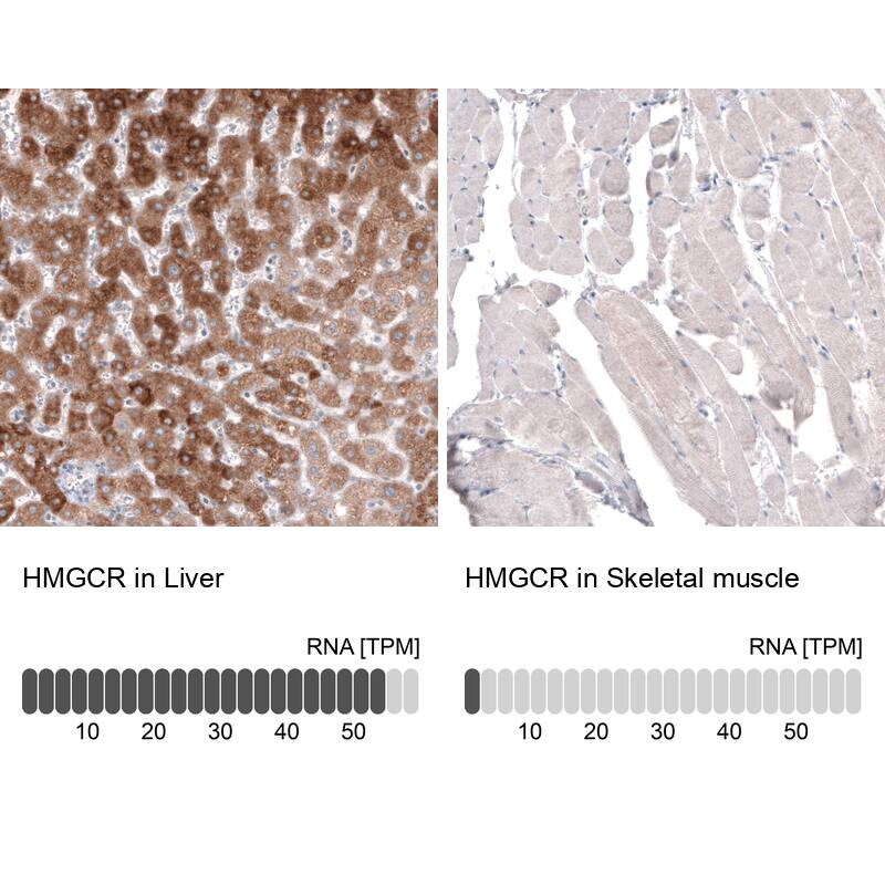 HMG-CoA Reductase/HMGCR Antibody (CL0259) Immunohistochemistry: HMG-CoA Reductase/HMGCR Antibody (CL0259) [NBP3-52097]