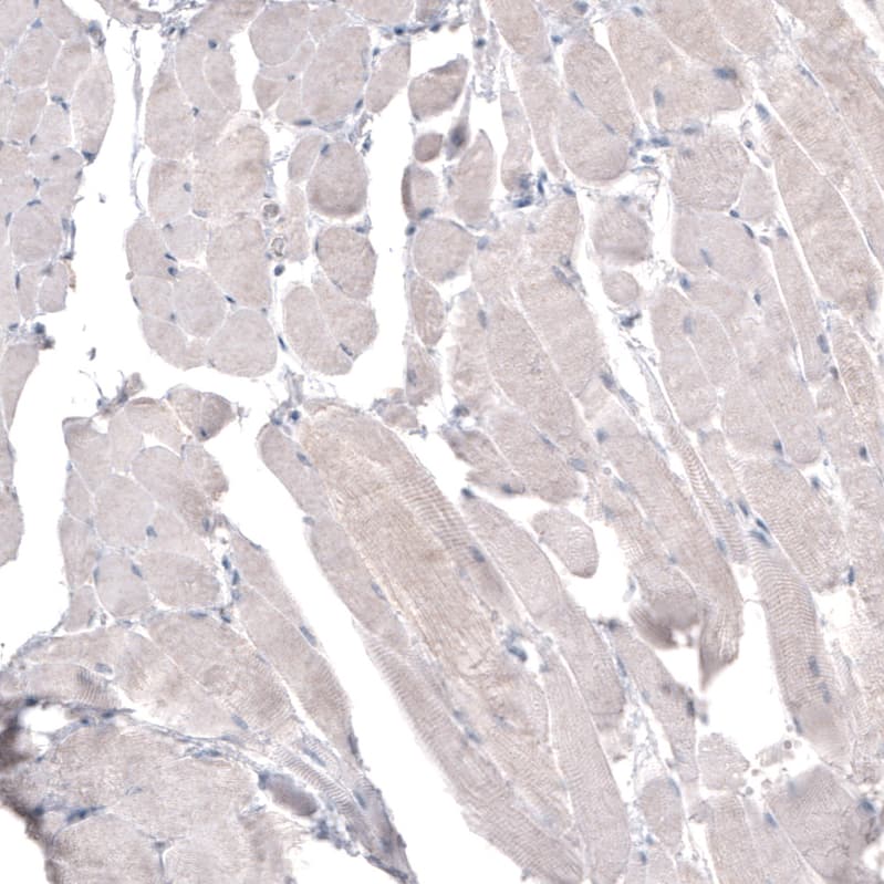 HMG-CoA Reductase/HMGCR Antibody (CL0259) Immunohistochemistry: HMG-CoA Reductase/HMGCR Antibody (CL0259) [NBP3-52097]