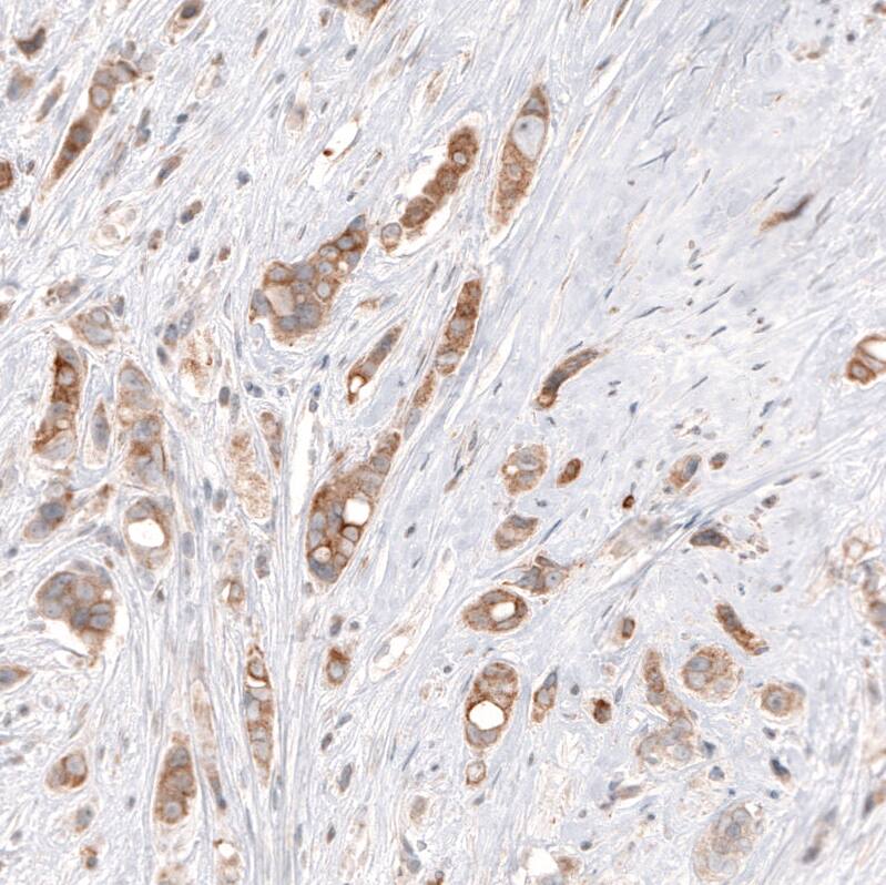 HMG-CoA Reductase/HMGCR Antibody (CL0259) Immunohistochemistry: HMG-CoA Reductase/HMGCR Antibody (CL0259) [NBP3-52097]