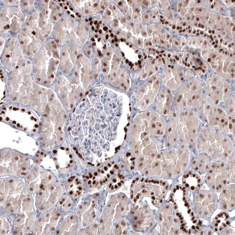Pax2 Antibody (CL9469) Immunohistochemistry: Pax2 Antibody (CL9469) [NBP3-52098]
