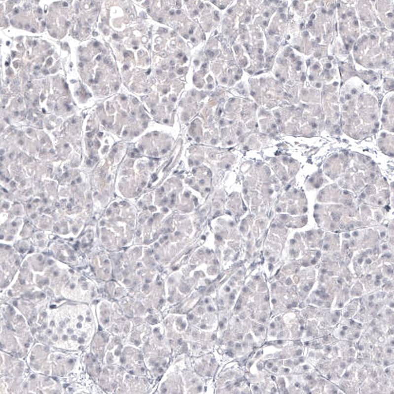 Pax2 Antibody (CL9469) Immunohistochemistry: Pax2 Antibody (CL9469) [NBP3-52098]