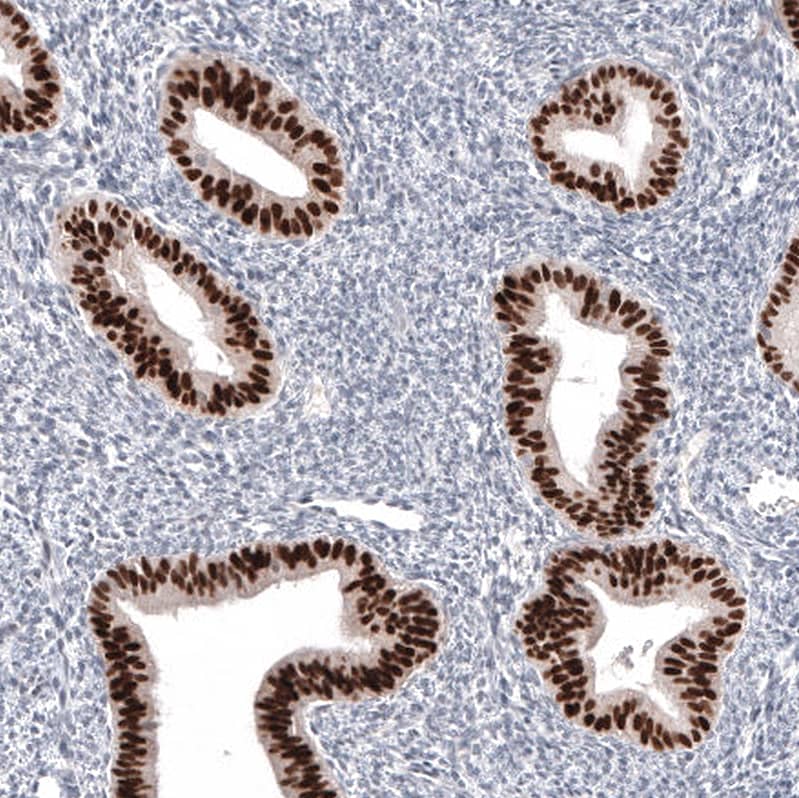 Pax2 Antibody (CL9469) Immunohistochemistry: Pax2 Antibody (CL9469) [NBP3-52098]