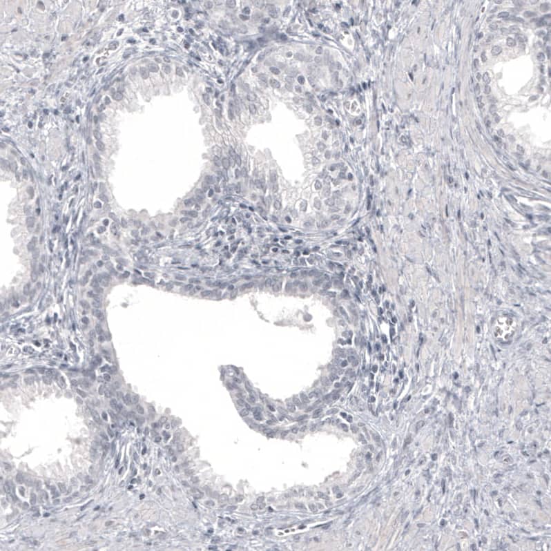 Pax2 Antibody (CL9469) Immunohistochemistry: Pax2 Antibody (CL9469) [NBP3-52098]