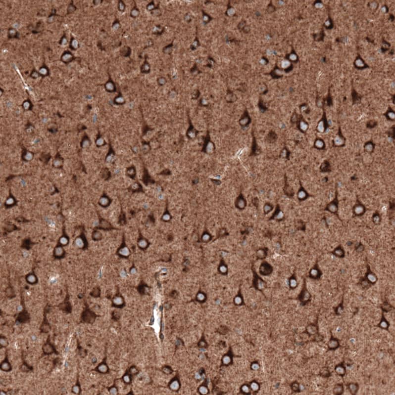 Sortilin Antibody (CL6526) Immunohistochemistry: Sortilin Antibody (CL6526) [NBP3-52100]