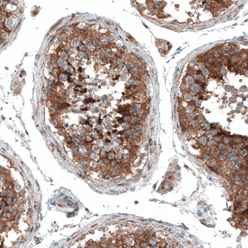 Sortilin Antibody (CL6526) Immunohistochemistry: Sortilin Antibody (CL6526) [NBP3-52100]