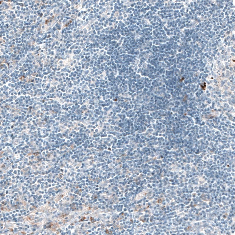 Sortilin Antibody (CL6526) Immunohistochemistry: Sortilin Antibody (CL6526) [NBP3-52100]