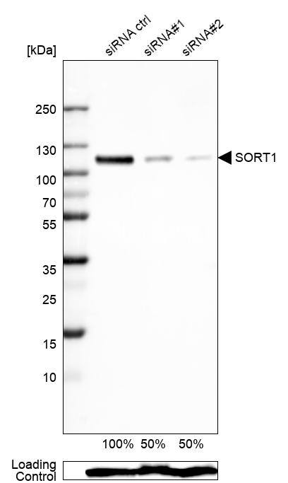 Sortilin Antibody (CL6526) Western Blot: Sortilin Antibody (CL6526) [NBP3-52100]