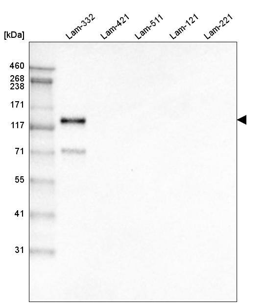 LAMC2 Antibody (CL2980) Western Blot: LAMC2 Antibody (CL2980) [NBP3-52101]