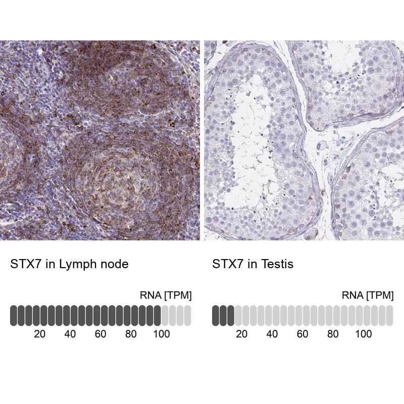 Syntaxin 7 Antibody (CL0257) Immunohistochemistry: Syntaxin 7 Antibody (CL0257) [NBP3-52102]