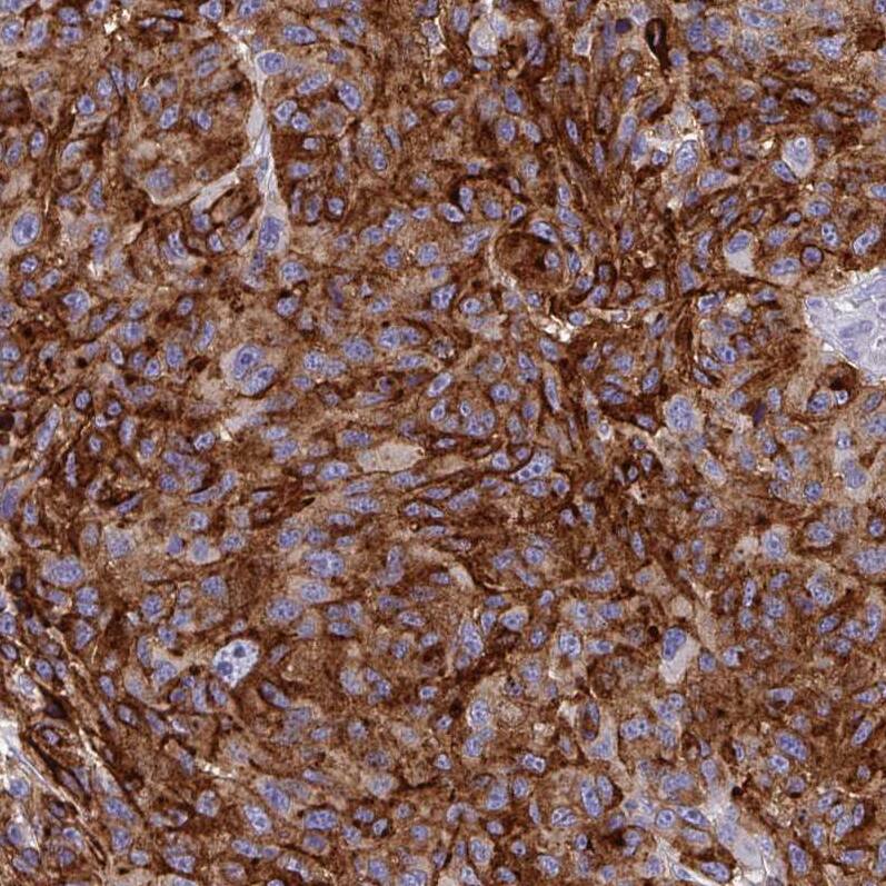 Syntaxin 7 Antibody (CL0257) Immunohistochemistry: Syntaxin 7 Antibody (CL0257) [NBP3-52102]
