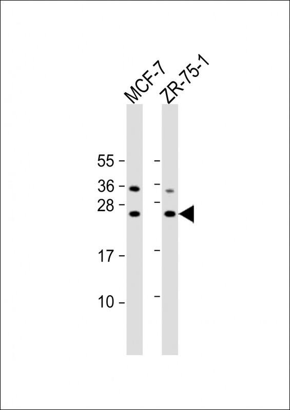 STAG3L1 Antibody (RB39888)