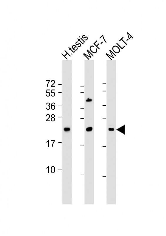 STAG3L1 Antibody (RB39888)