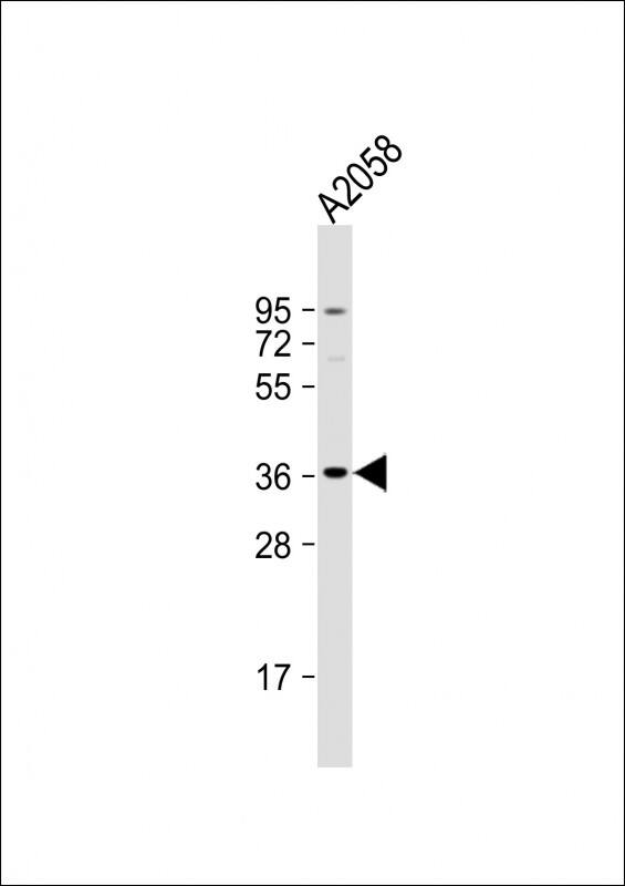OR52J3 Antibody (RB40815)