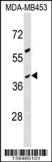 OR10G8 Antibody (RB39460)
