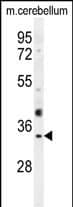 OR51I1 Antibody (RB28513)