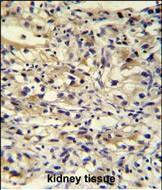 C1orf186 Antibody (RB27426)
