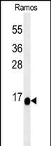 C1orf186 Antibody (RB27426)