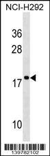 RPS17 Antibody (RB39782)