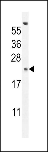 G antigen 13 Antibody (RB28268)