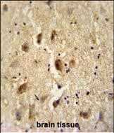Vitrin Antibody (RB27060)