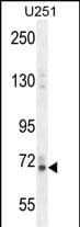 Vitrin Antibody (RB27060)