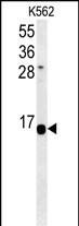 HIST1H2AK Antibody (RB26883)