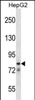 CATSPER1 Antibody (RB32588)