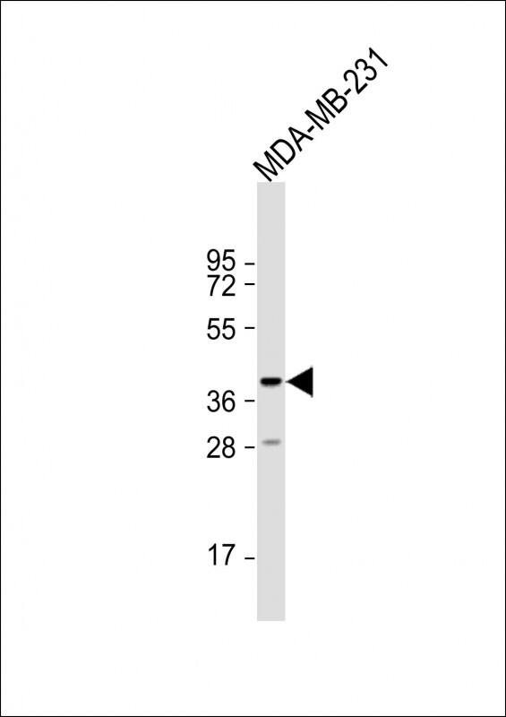 TAS2R44 Antibody (RB35870)