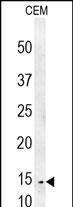 CRCT1 Antibody (RB27599)