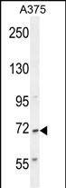 ALS2CR11 Antibody (RB28453)