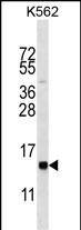 HIST1H2BL Antibody (RB32146)