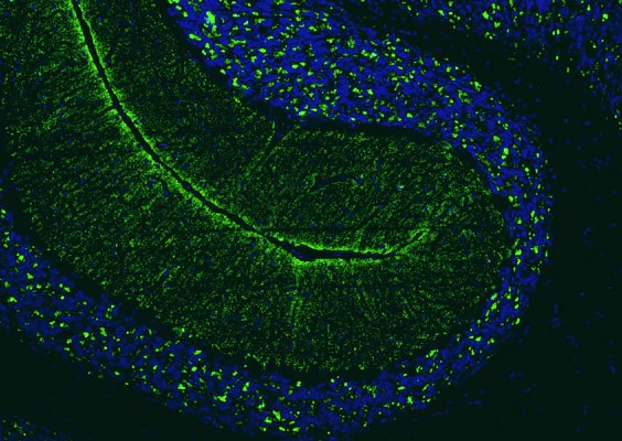 Immunohistochemistry-Paraffin: VGLUT2 Antibody (N29/29) - Chimeric - BSA Free [NBP3-52338]