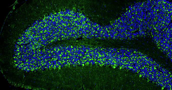 Immunohistochemistry-Paraffin: Bassoon Antibody (L124/59) - Chimeric - Azide and BSA Free [NBP3-52353]