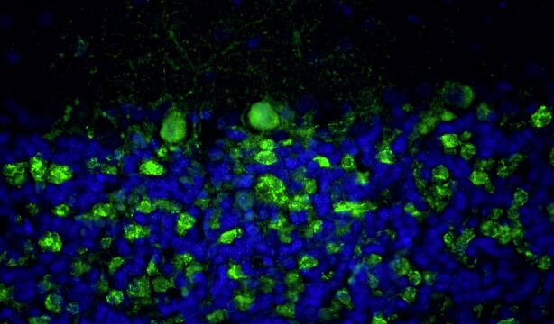 Immunohistochemistry-Paraffin: Bassoon Antibody (L124/59) - Chimeric - Azide and BSA Free [NBP3-52353]
