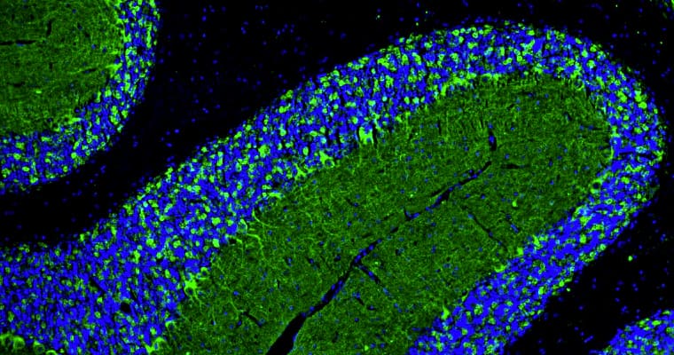 Immunohistochemistry-Paraffin: GAD65/67 Antibody (L127/12) - Chimeric - BSA Free [NBP3-52354]