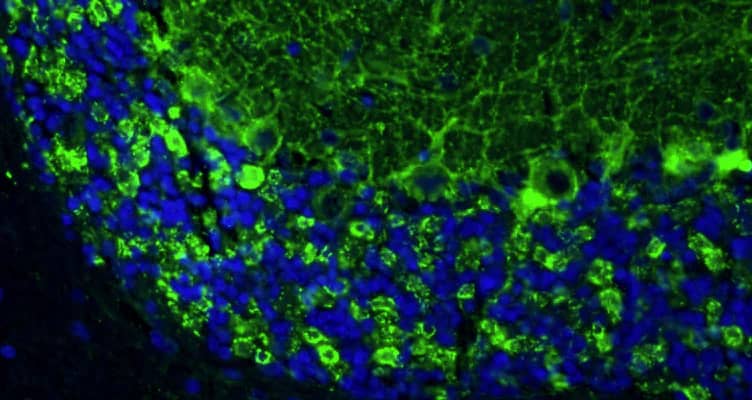 Immunohistochemistry-Paraffin: GAD65/67 Antibody (L127/12) - Chimeric - BSA Free [NBP3-52354]