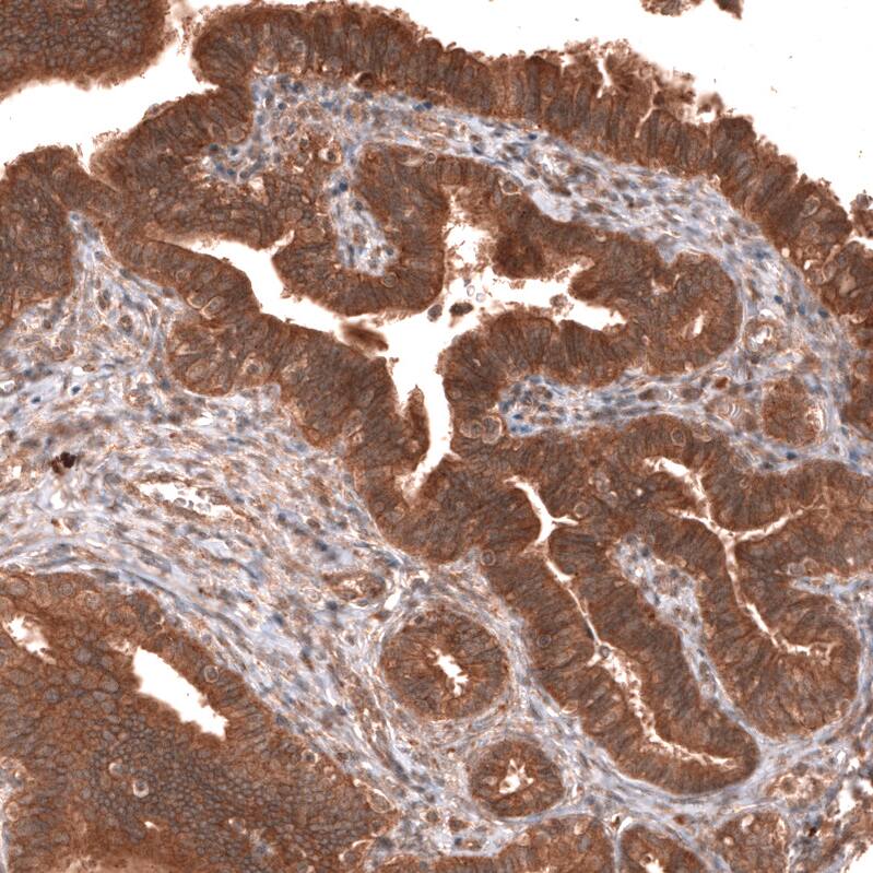 YAP1 Antibody (CL13628) Immunohistochemistry-Paraffin: Aquaporin-4 Antibody (CL0178) [NBP3-52443]