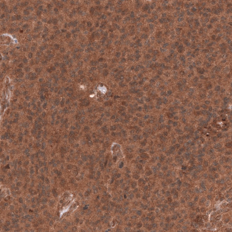 YAP1 Antibody (CL13628) Immunohistochemistry-Paraffin: HMG-CoA Reductase/HMGCR Antibody (CL0259) [NBP3-52446]