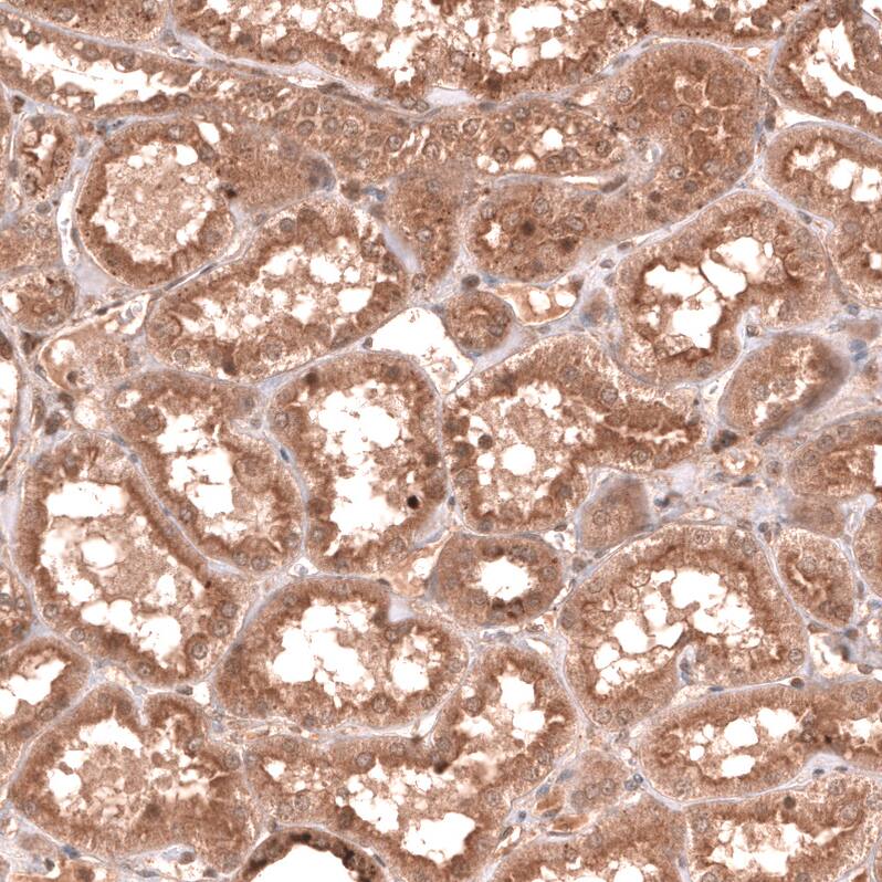 YAP1 Antibody (CL13628) Immunohistochemistry-Paraffin: Aquaporin-4 Antibody (CL0178) [NBP3-52443]