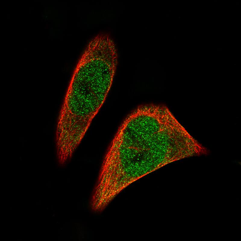 SOX11 Antibody (CL0142) Immunohistochemistry-Paraffin: SATB2 Antibody (CL0320) [NBP3-52448]