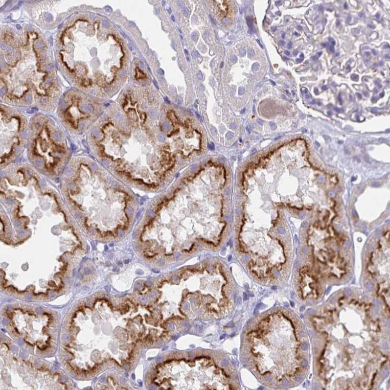 Syntaxin 7 Antibody (CL0257) Immunohistochemistry-Paraffin: Syntaxin 7 Antibody (CL0257) [NBP3-52445]