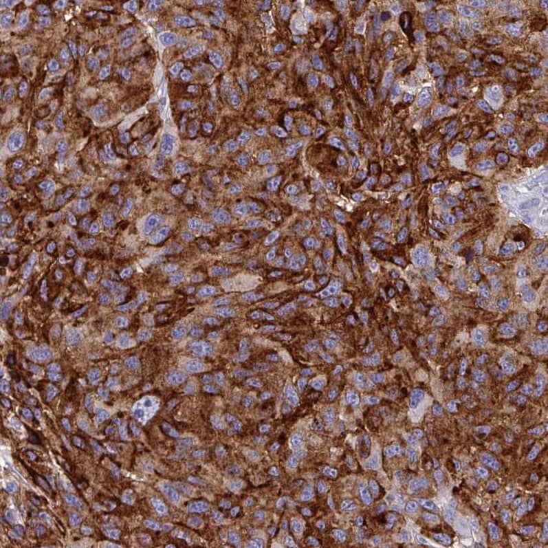 Syntaxin 7 Antibody (CL0257) Immunohistochemistry-Paraffin: SOX11 Antibody (CL0143) [NBP3-52442]