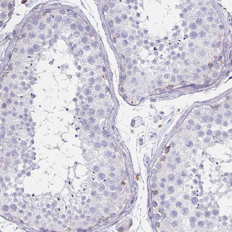Syntaxin 7 Antibody (CL0257) Immunohistochemistry-Paraffin: PCM1 Antibody (CL0206) [NBP3-52444]