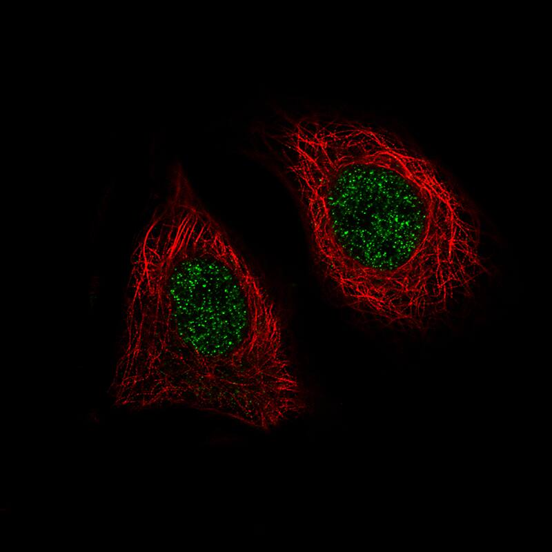 Immunocytochemistry/ Immunofluorescence: BRD4 Antibody (CL1115) [NBP3-52453]