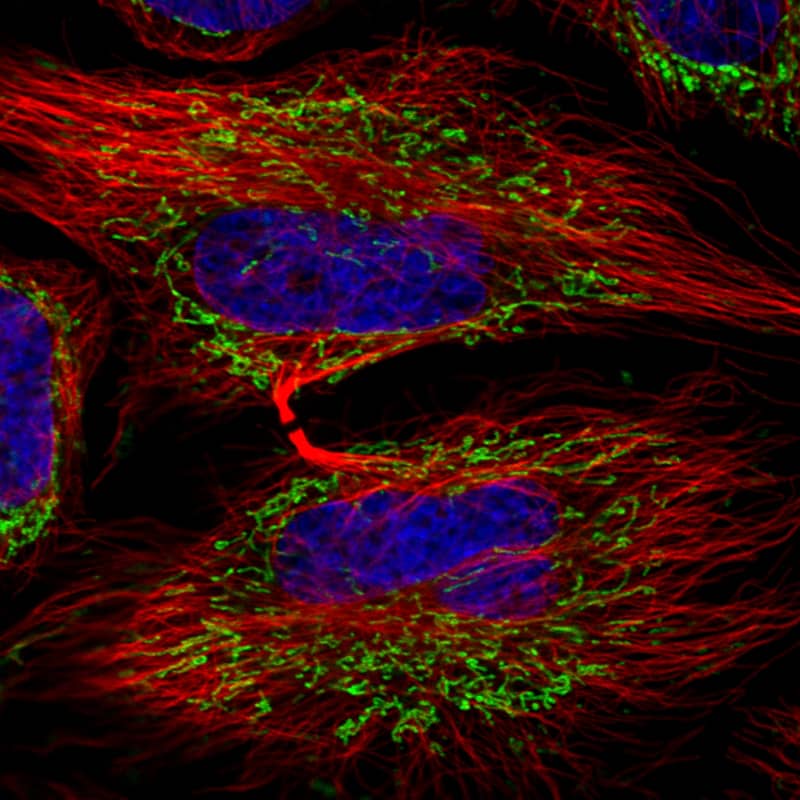 Immunocytochemistry/ Immunofluorescence: TUFM Antibody (CL2242) [NBP3-52456]