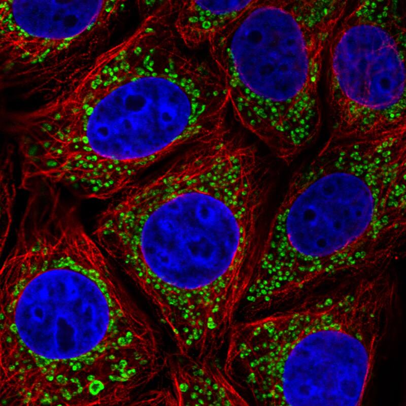 Immunocytochemistry/ Immunofluorescence: TUFM Antibody (CL2242) [NBP3-52456]
