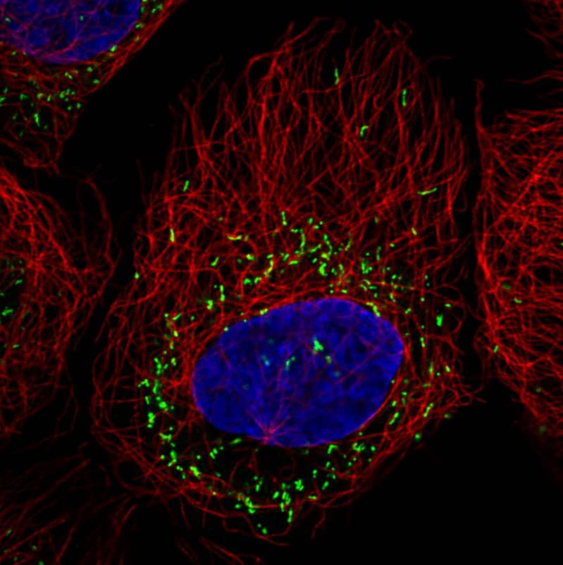 Immunocytochemistry/ Immunofluorescence: PMP70 Antibody (CL2524) [NBP3-52459]